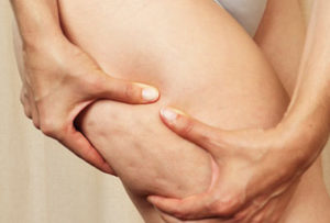 cellulite-linfodrenaggio-vodder-riccardo-rezzani-osteopatiaitalia