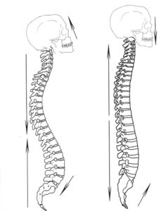 postura-osteopatiaitalia-riccardorezzani